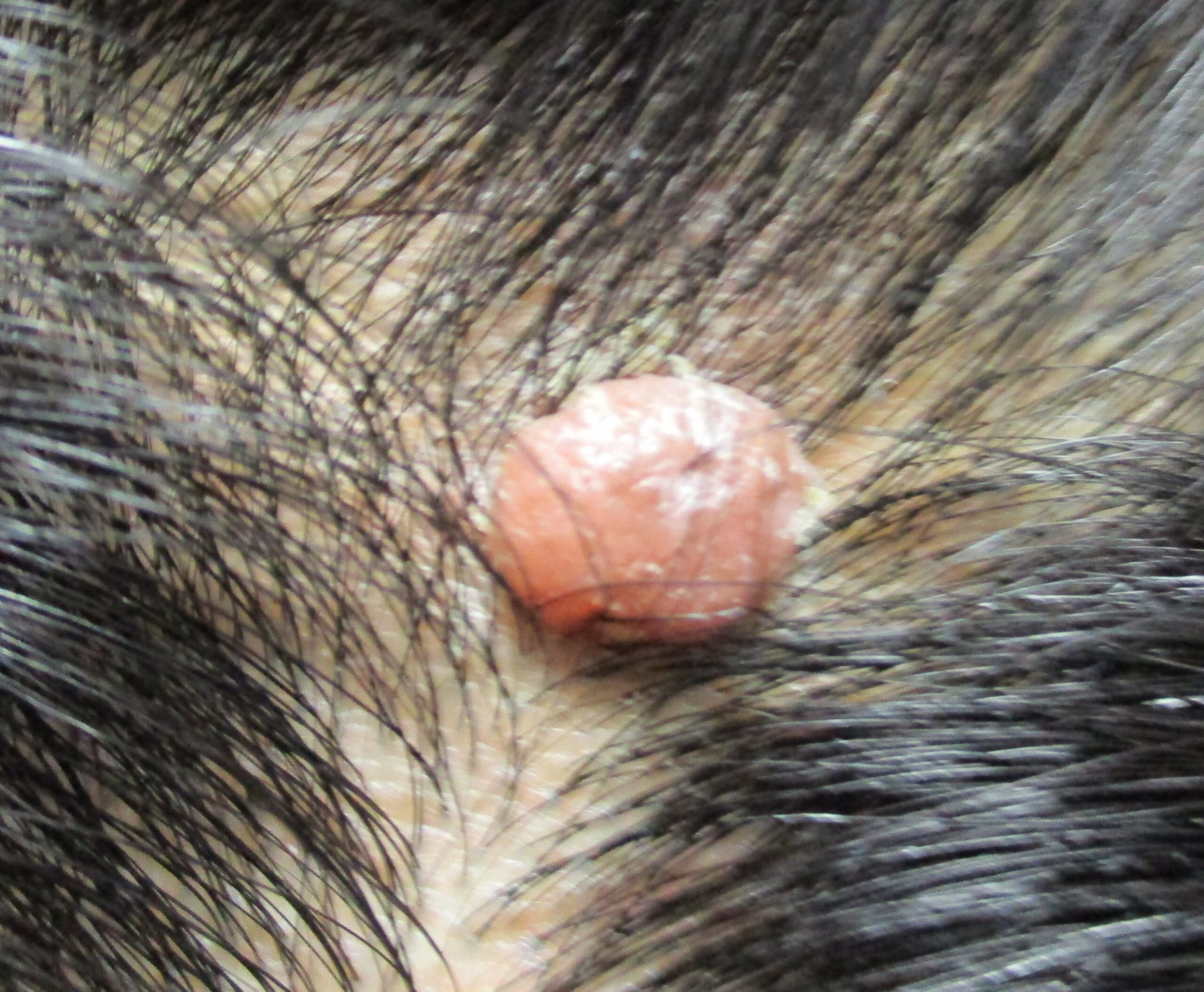 ほくろ除去 やまもと形成外科クリニック