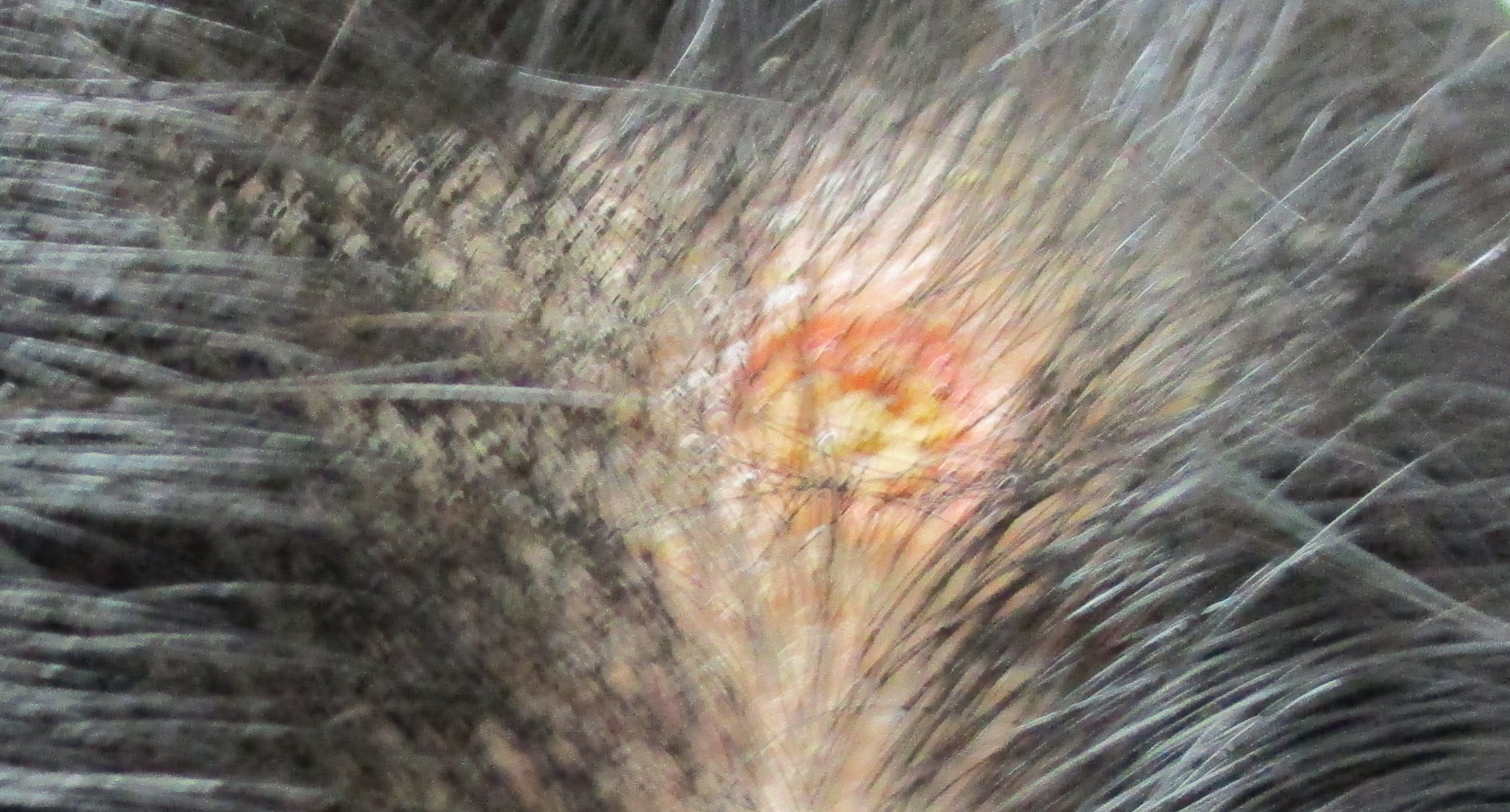 ほくろ除去 やまもと形成外科クリニック